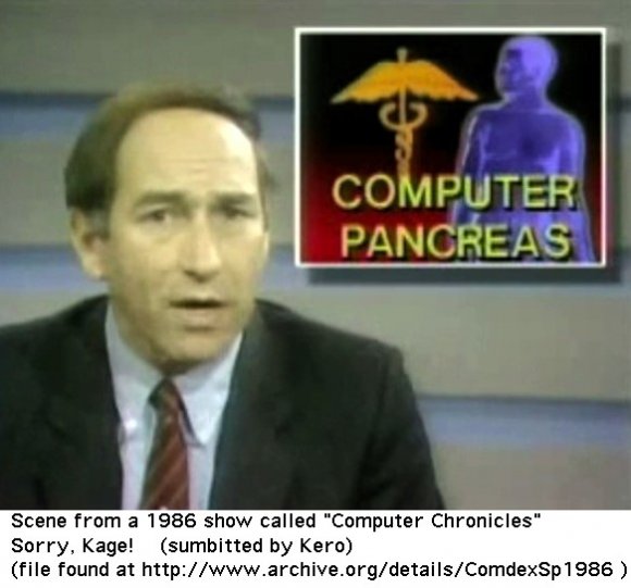 1_Computer_Pancreas