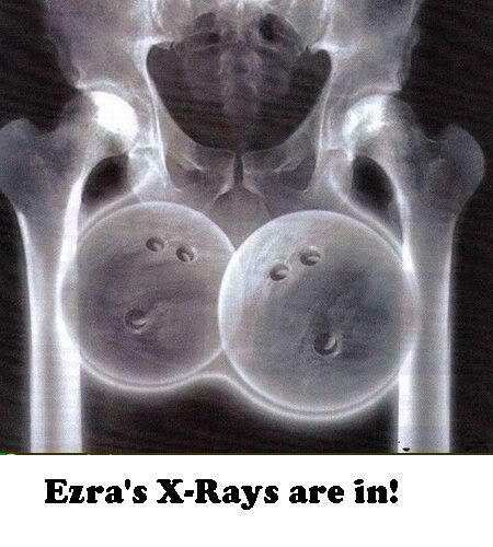 Anonymous-bowling_ball_balls