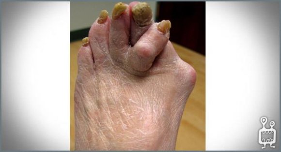 398979_119361138180733_855665798_n[1]