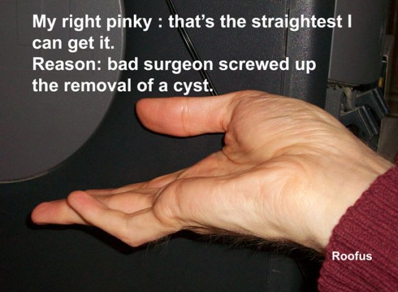 2013-01-20 Roofus crooked pinky